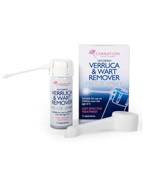 Carnation Verruca & Wart Remover Freeze Spray 50ml